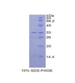 白介素31受体A(IL31RA)重组蛋白