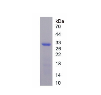 低密度脂蛋白受体相关蛋白3(LRP3)重组蛋白