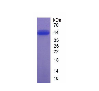 蛋白激酶Bα(PKBa)重组蛋白
