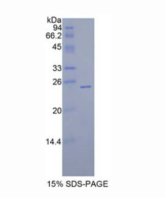 侧支发芽因子同源物1(SPRY1)重组蛋白