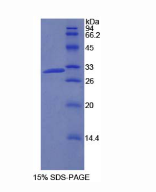 磷酸肌醇-3-激酶2β肽(PIK3C2b)重组蛋白