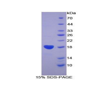 骨成型蛋白受体2(BMPR2)重组蛋白