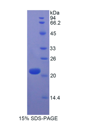 细胞程序性死亡蛋白6(PDCD6)重组蛋白