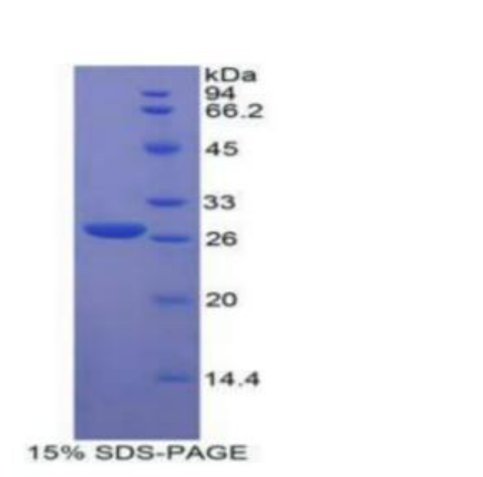 成纤维细胞生长因子受体样蛋白1(FGFRL1)重组蛋白