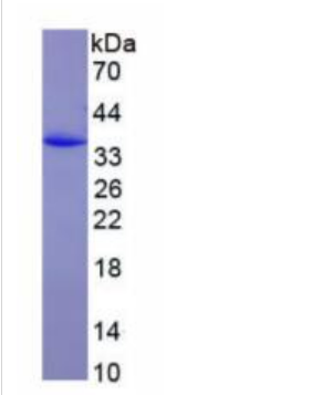 含卷曲螺旋C2域蛋白1A(CC2D1A)重组蛋白