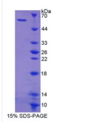 猫眼综合征染色体区候选基因1(CECR1)重组蛋白