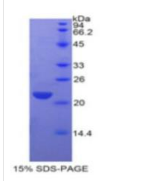 C-型凝集素域家族3成员B(CLEC3B)重组蛋白
