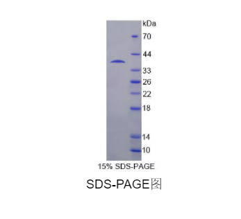 USP6氨基端样蛋白(USP6NL)重组蛋白