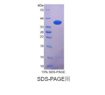 N-myc下游调节基因2(NDRG2)重组蛋白