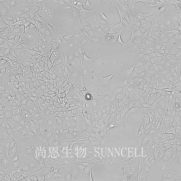 MDCK[NBL-2]（狗肾细胞）