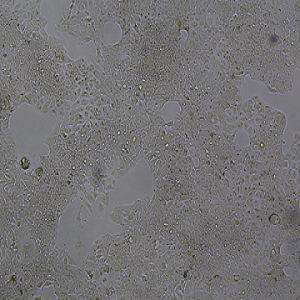 HCC827细胞|HCC827人肺腺癌细胞