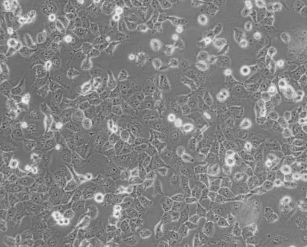 NCI-H1299细胞|NCI-H1299人非小细胞肺癌细胞