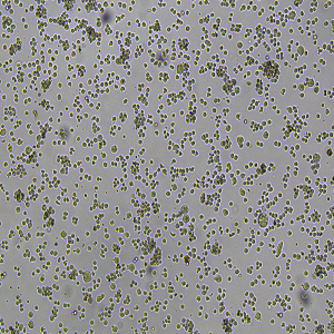 U266 [U266B1]细胞|U266人多发性骨髓瘤细胞