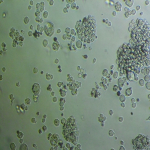 THP-1人急性单核细胞白血病细胞
