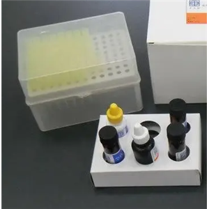 人细胞膜表面免疫球蛋白(SmIg)Elisa试剂盒