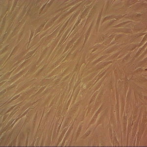 HRCEC细胞