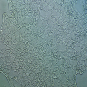 CNE-2人鼻咽细胞