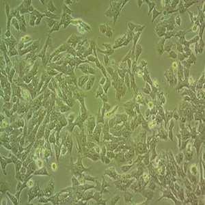 Calu-6人肺退行性细胞