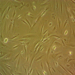 人急性淋巴母细胞病细胞