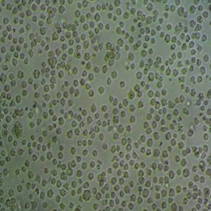 JM-1人B细胞淋巴细胞