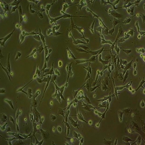 人脑星形胶质母细胞细胞