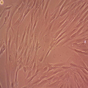 SW-13人肾上腺皮质腺细胞