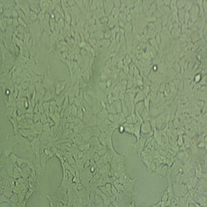 人绒毛膜滋养层 细胞