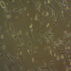 OCI-LY3人弥漫大B细胞淋巴瘤细胞