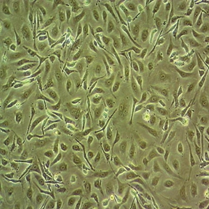 大鼠嗜碱性细胞病细胞