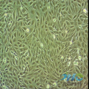 SGC7901-GFP细胞