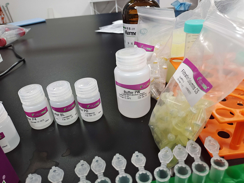 SMARCE1 (Human) Recombinant Protein (Q01)