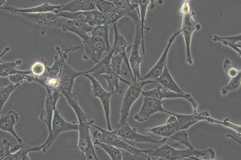 A172（人胶质母细胞瘤细胞） (STR鉴定正确)