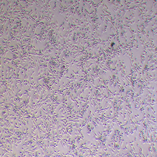 3T3-L1小鼠胚胎成纤维细胞