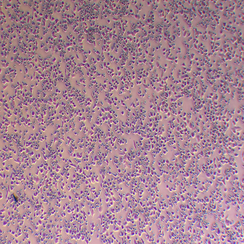 hepa1-6小鼠肝癌细胞