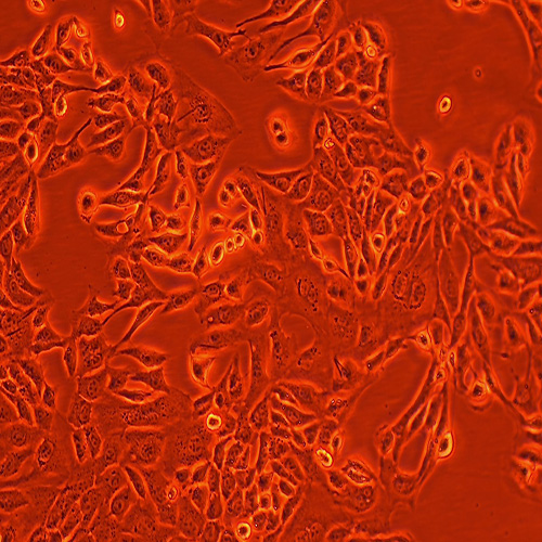 ID8小鼠卵巢上皮癌细胞