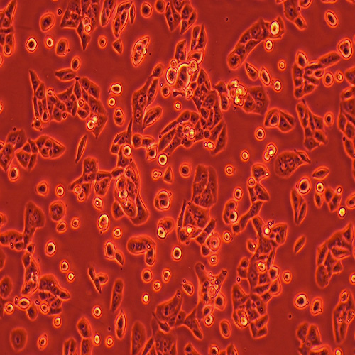 RENCA小鼠肾癌细胞