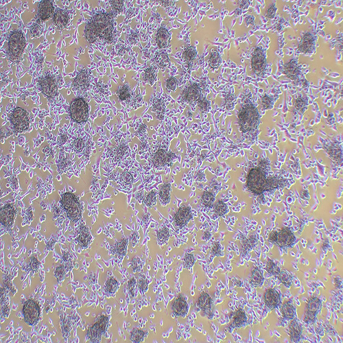 U14小鼠子宫颈癌细胞（种属鉴定正确）