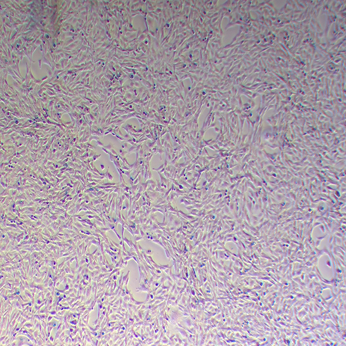 CTX-TNA2大鼠脑I型星形胶质细胞