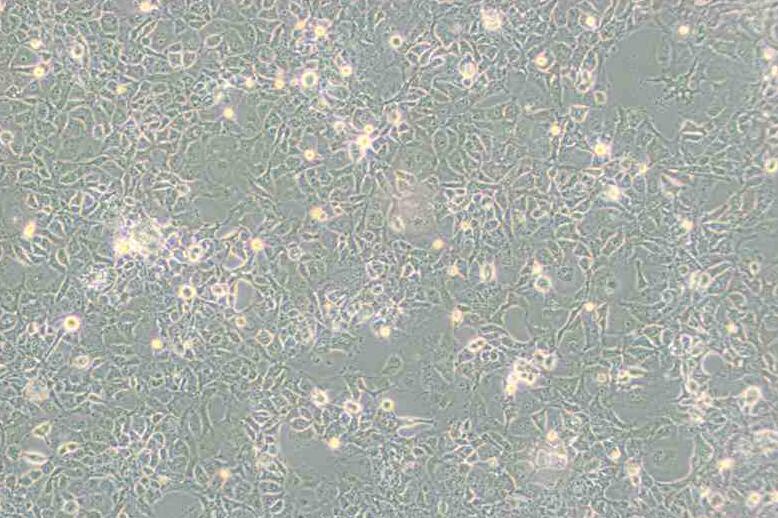 COS-1（非洲绿猴SV40转化的肾细胞）