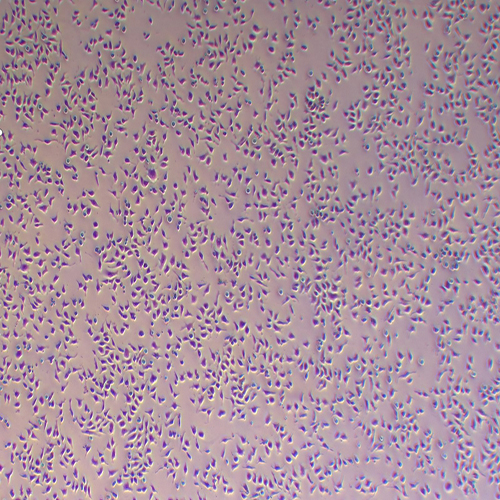 LMH鸡肝癌细胞