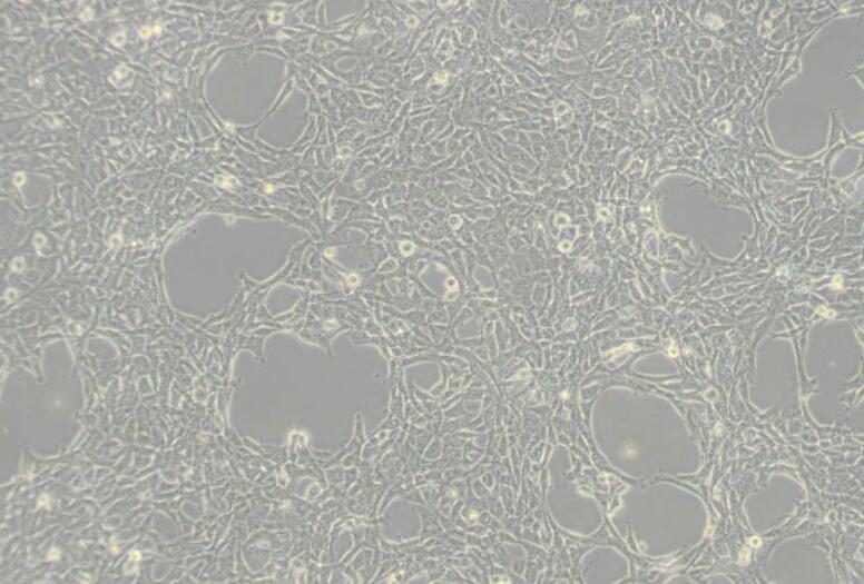 HBL-100（人整合SV40基因的乳腺上皮细胞）