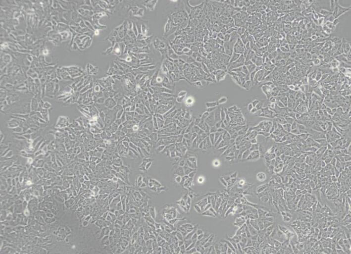 HCT-15（人结直肠腺癌细胞）