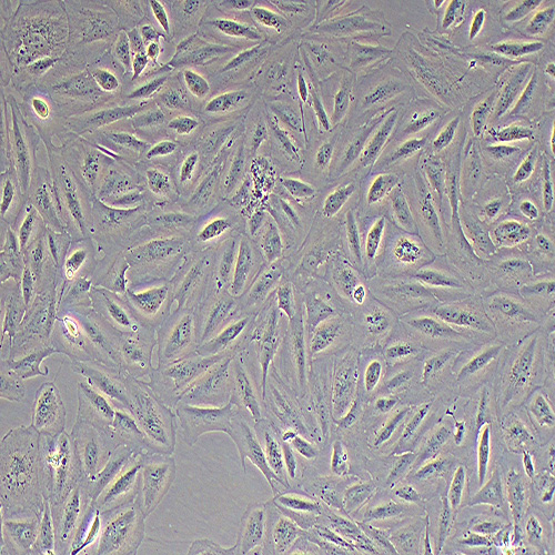 ARPE-19人视网膜色素上皮细胞（STR鉴定正确）