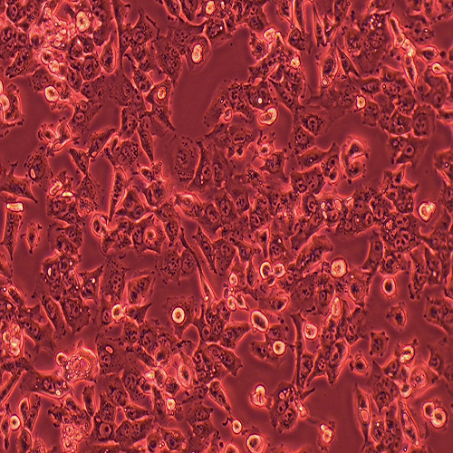 BHT101人甲状腺癌细胞（STR鉴定正确）