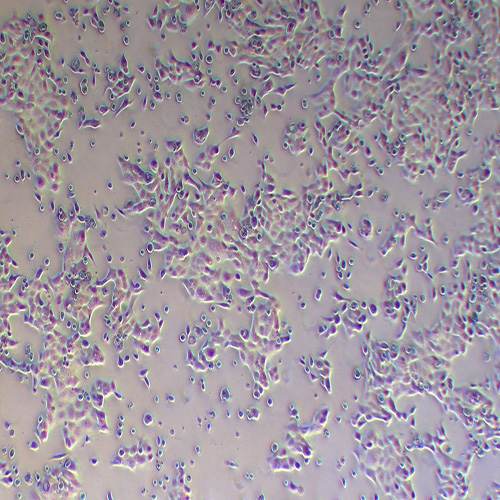 CFPAC-1人胰腺癌细胞