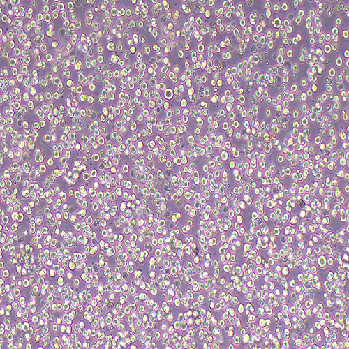 CoC1人卵巢癌细胞（STR鉴定正确）