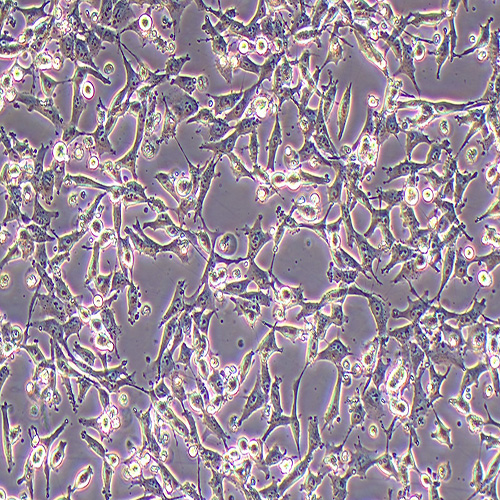 ES-2人卵巢透明细胞癌细胞（STR鉴定正确）