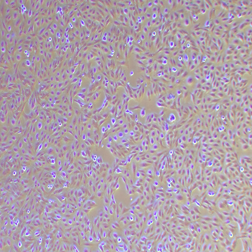GES-1人胃黏膜上皮细胞（STR鉴定正确）