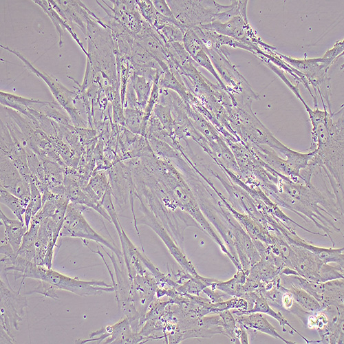 HFL-1人胚肺成纤维细胞（STR鉴定正