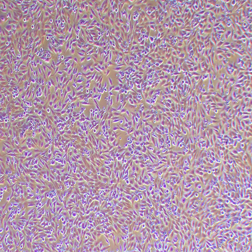 HGC-27人胃癌细胞（STR鉴定正确）